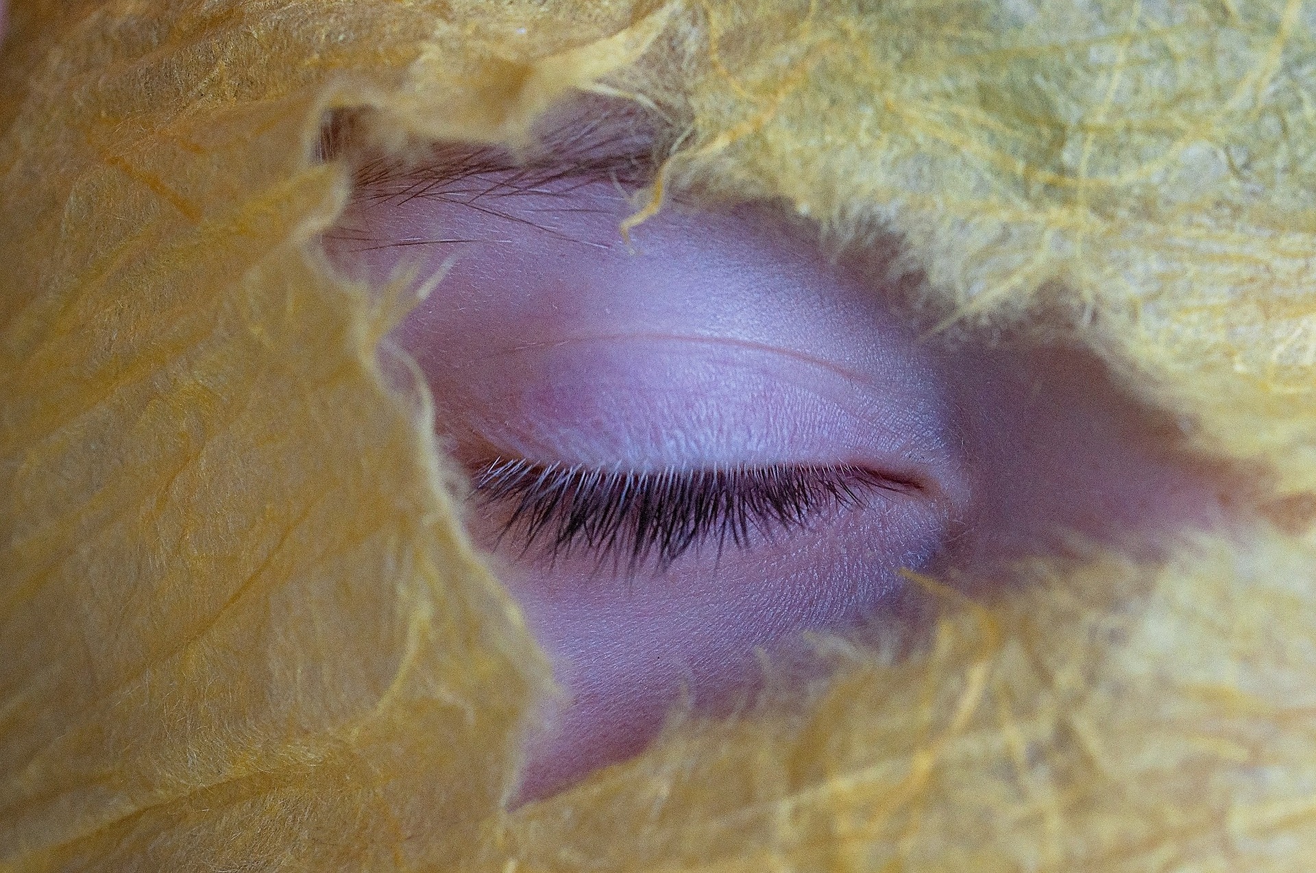 Patologie della palpebra e chirurgia palpebrale